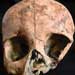 ‘The Halved Heads’: Osteological Evidence for Decapitation in Medieval Ireland